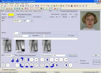 скриншот Дентал-Софт