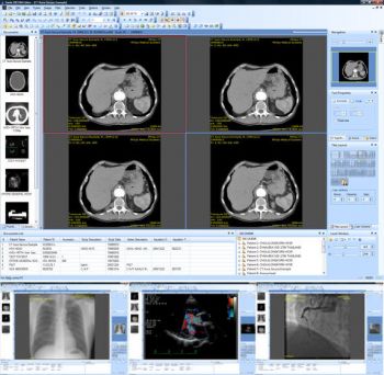 скриншот Sante DICOM Editor