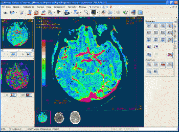 скриншот Махаон PACS